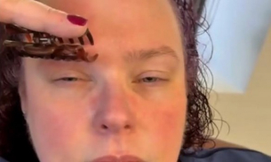 Блогърки стискат веждите си със щипки срещу главоболие